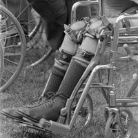 Close-up photo of legs wearing braces and in a wheelchair